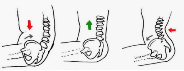 Imagen de la posición correcta de caderas y glúteos sentados en una silla
