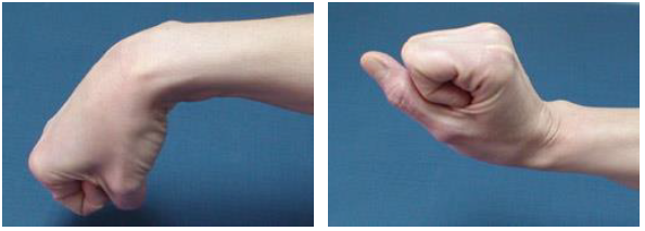 Imagen de flexión y extensión de muñeca
