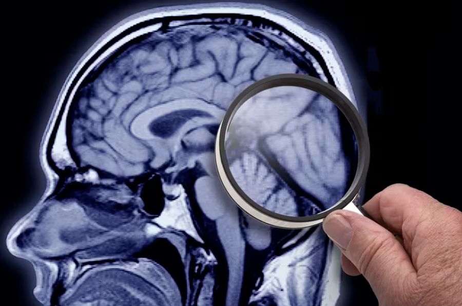 Cerebro humano