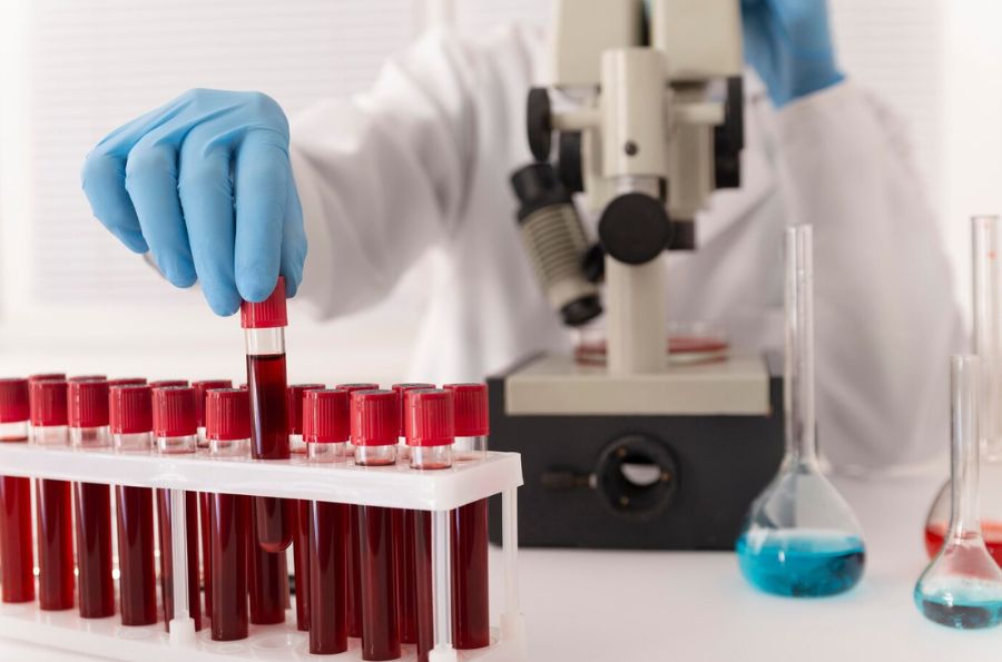 Muestras de sangre en laboratorio