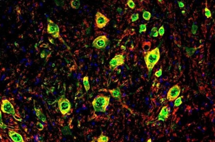 Neuronas